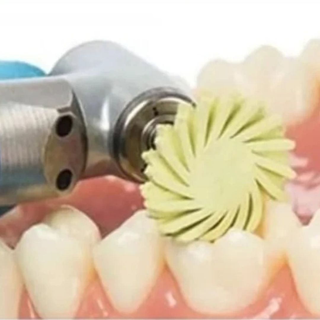 Système de polissage diamanté RA (basse vitesse) pour résine et céramique – 6 pièces