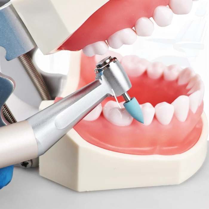 Kit de polissage et de finition pour résine – 12 pièces (basse vitesse)