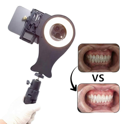 Support pour photographie orale V4 – compatible avec tous les modèles d’iPhone et Android